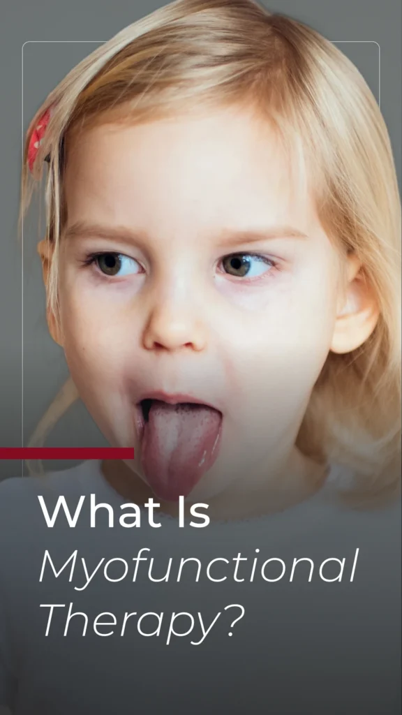 What Is Myofunctional Therapy?